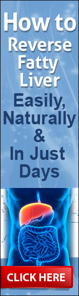 Best treatment for fatty liver